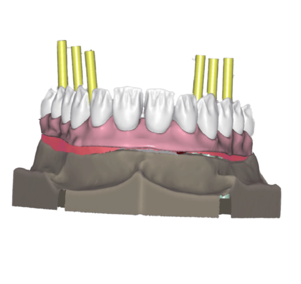 Evolve Dentistry: USA's Trusted Dental CAD/CAM Reseller